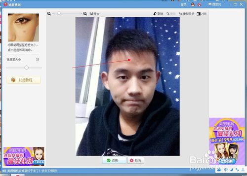 美图秀秀怎么祛疤 美图秀秀祛疤教程