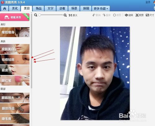 美图秀秀怎么祛疤 美图秀秀祛疤教程