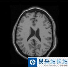 Python可视化mhd格式和raw格式的医学图像并保存