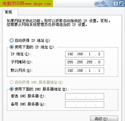 设置ip等