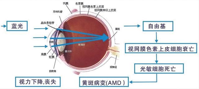 护眼显示器真护眼吗 护眼显示器有用吗