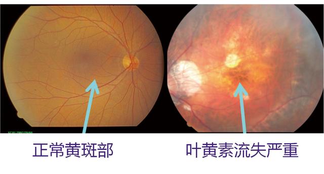 护眼显示器真护眼吗 护眼显示器有用吗